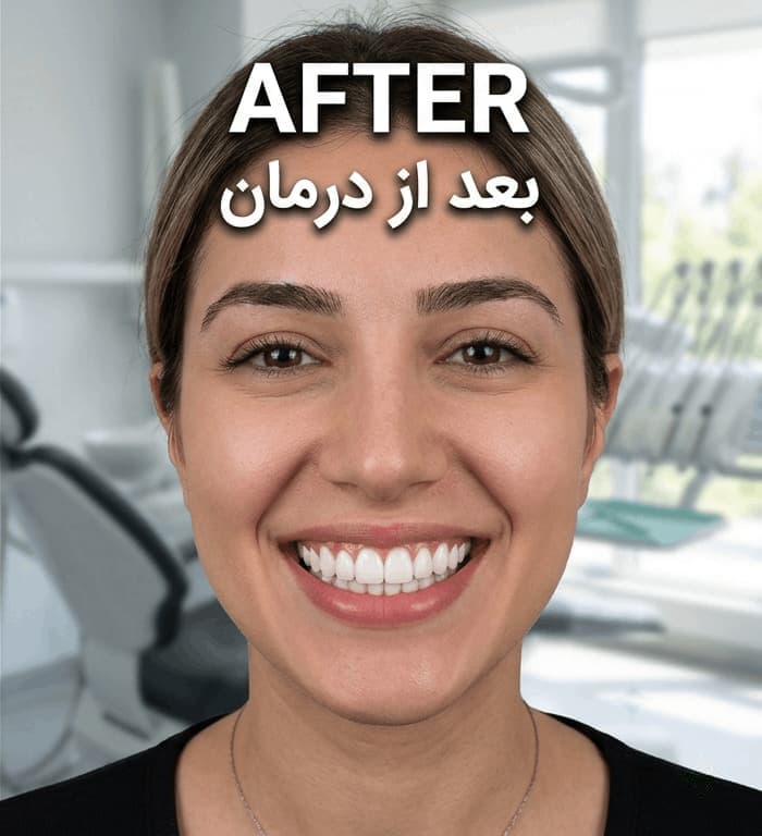 طب الأسنان الطبي after treatment result at IranElaj